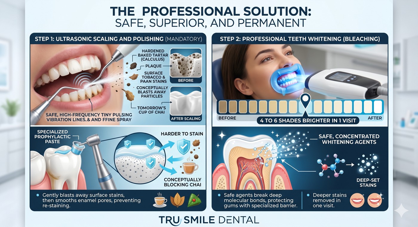 The Tru Smile Dental two-step professional solution for stained teeth at our Jogeshwari West Mumbai clinic: Step 1 ultrasonic scaling and polishing safely blasts away tobacco, paan and chai stains; Step 2 in-clinic LED whitening with safe concentrated bleaching agents delivers 4 to 6 shades brighter in a single visit